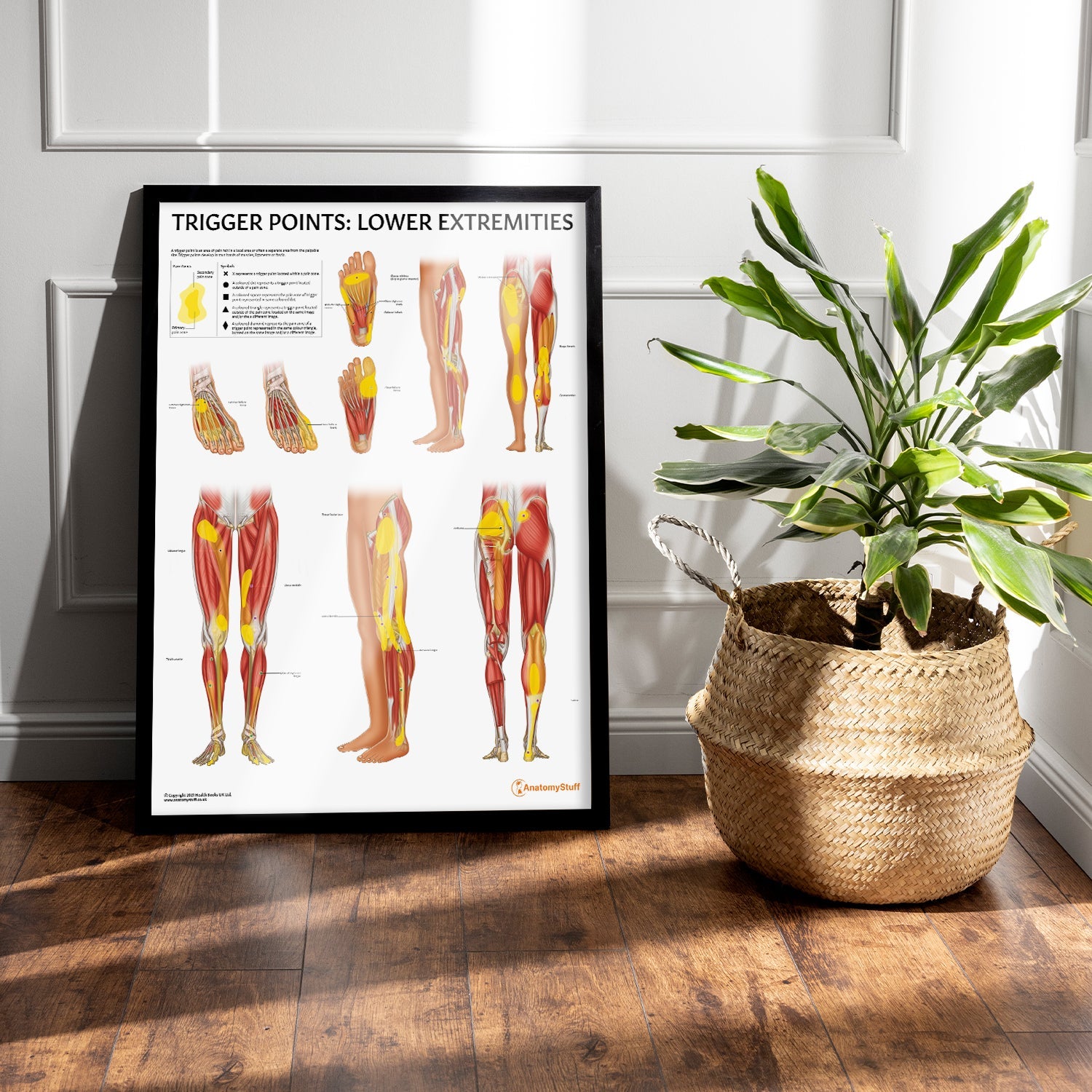 Trigger Points: Lower Extremities Chart / Poster - Part of Collection