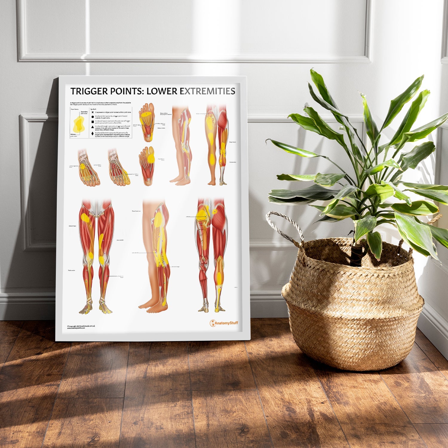 Trigger Points: Lower Extremities Chart / Poster - Part of Collection