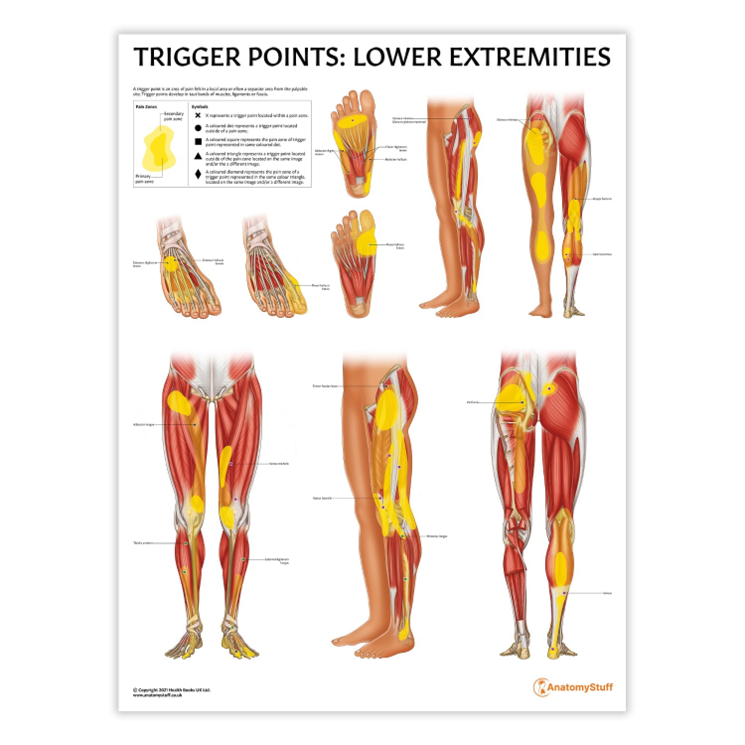 Trigger Points: Lower Extremities Chart / Poster - Part of Collection