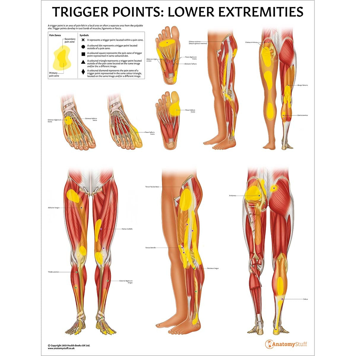 Trigger Points 3 Poster Collection