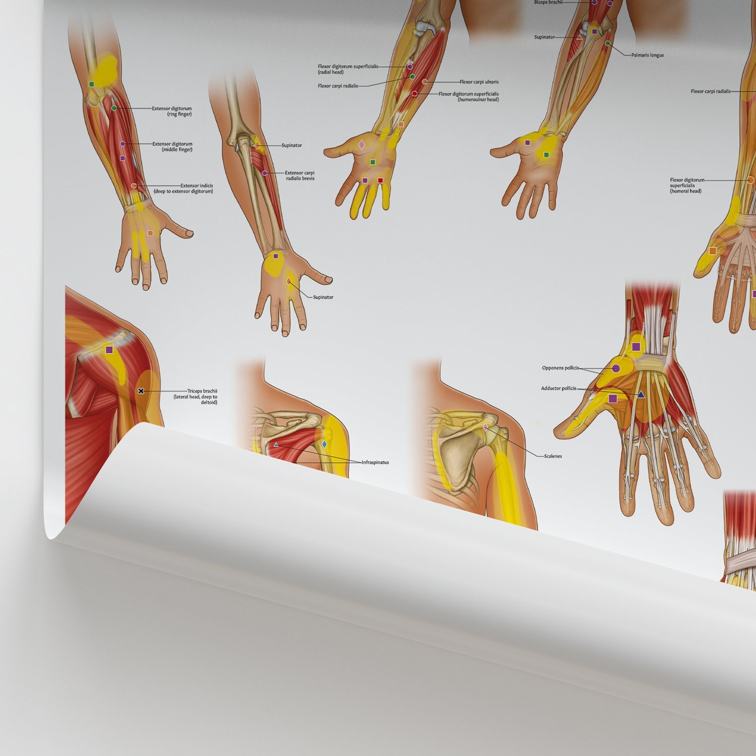 Trigger Points: Upper Extremities Chart / Poster - Part of Collection