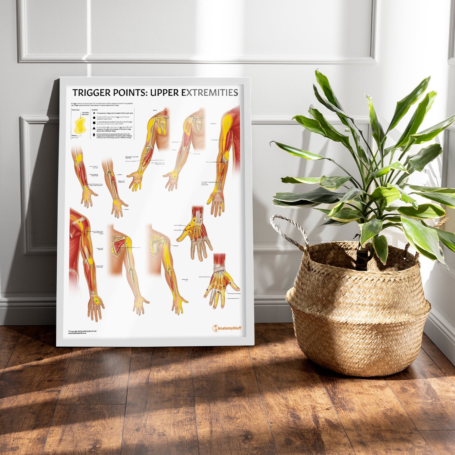 Trigger Points: Upper Extremities Chart / Poster - Part of Collection