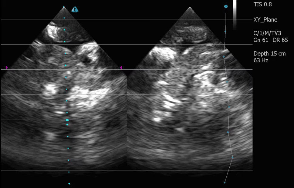 Adult Heart Phantom for X-Ray CT, US, MRI