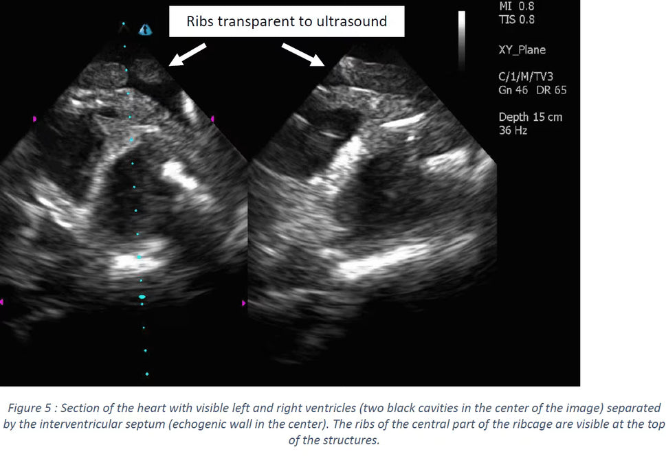 Adult Heart Phantom for X-Ray CT, US, MRI