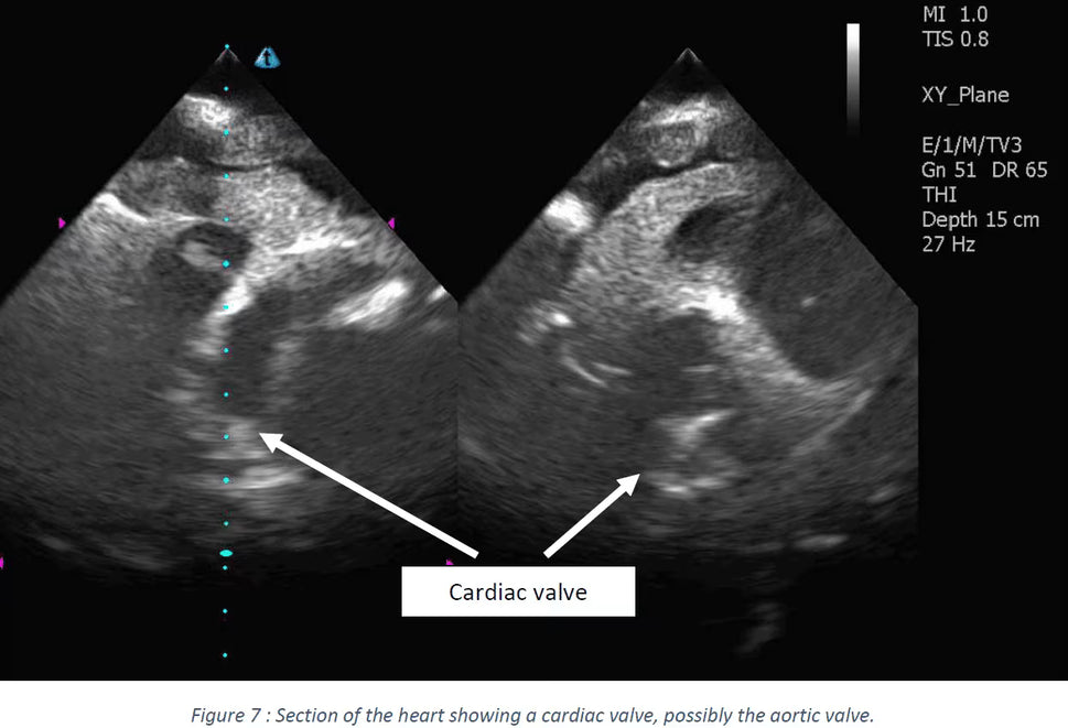 Adult Heart Phantom for X-Ray CT, US, MRI