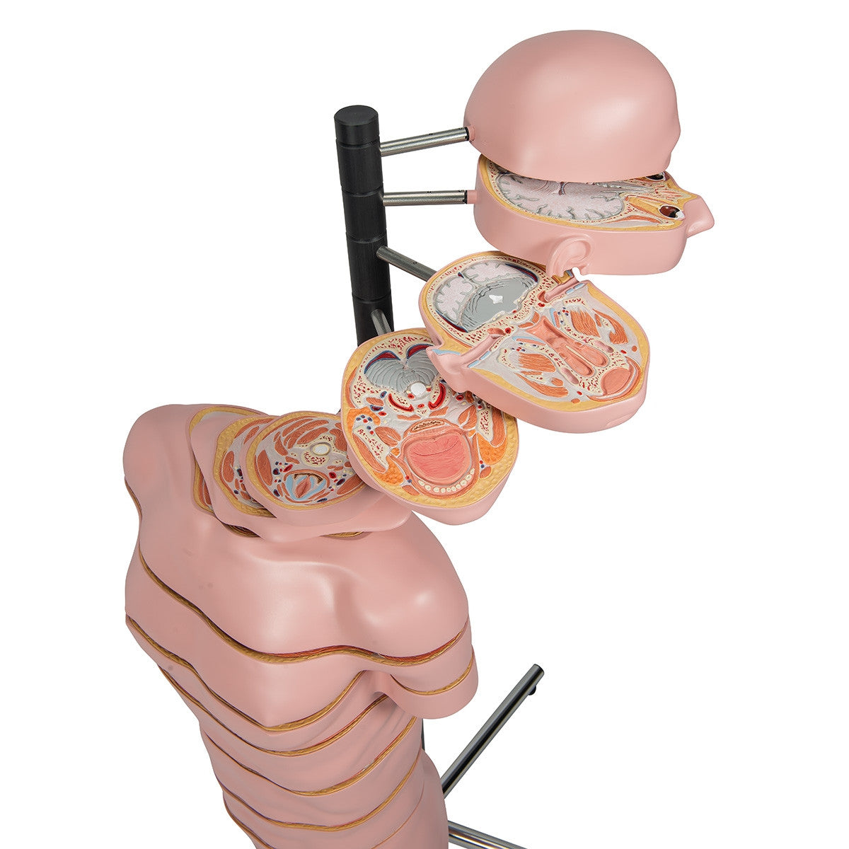 MRI Torso Model (15 Transverse Sections)