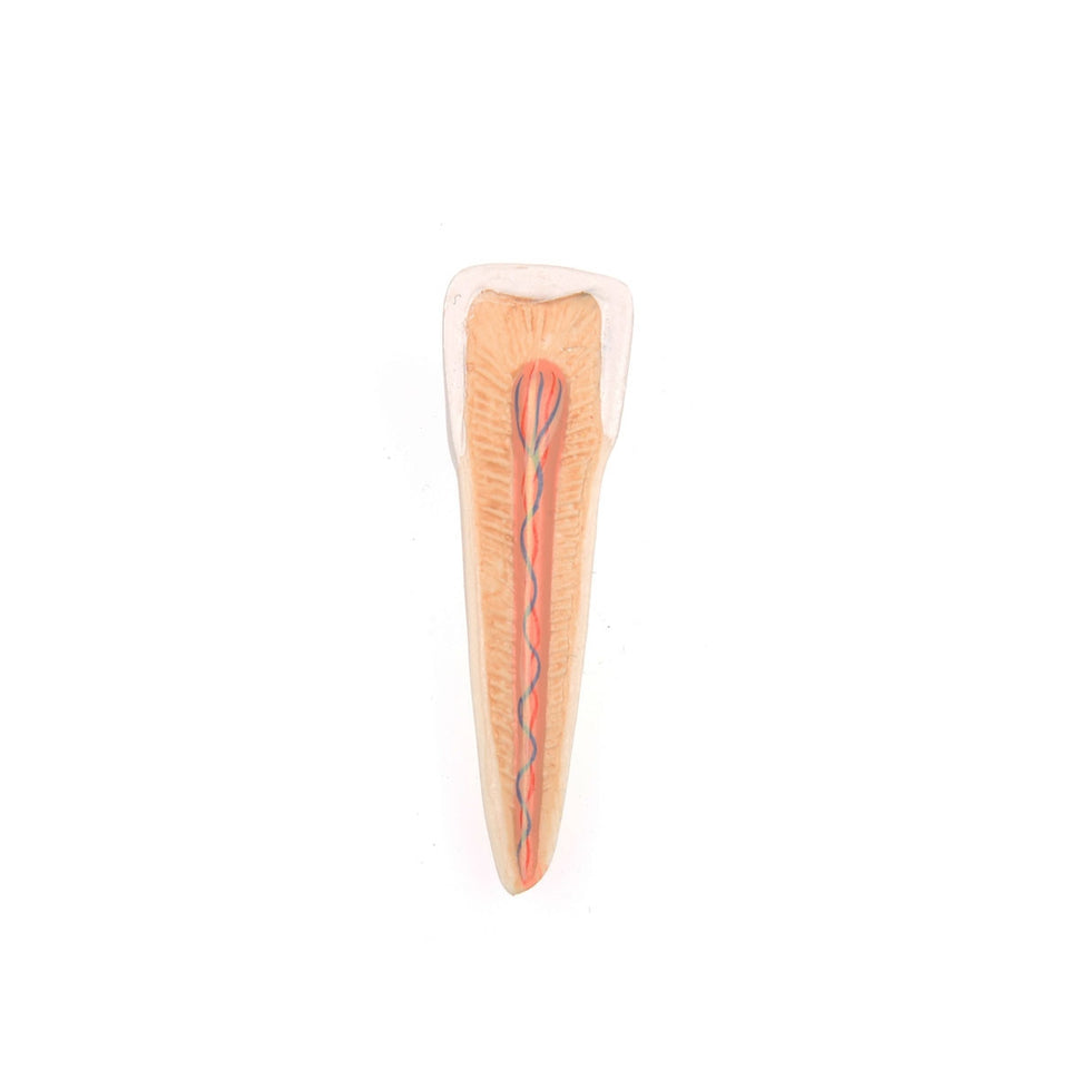 Half Lower Jaw Model with 8 Diseased Teeth (19 part)