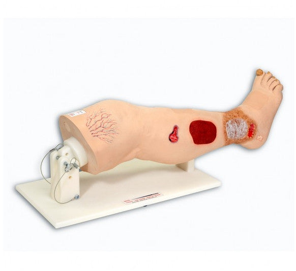 Vinnie Venous Insufficiency Leg