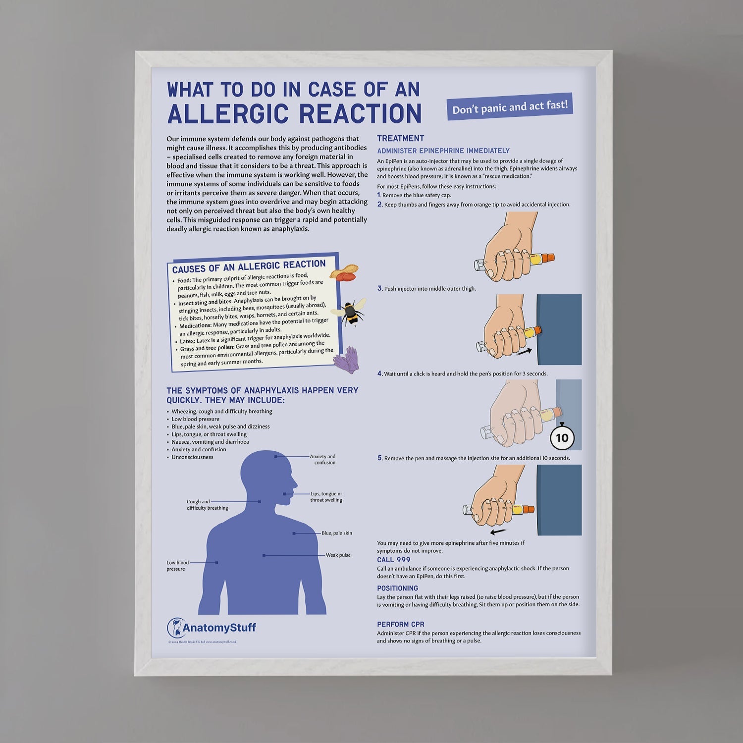 What to Do In Case of An Allergic Reaction Chart / Poster - Part of Collection
