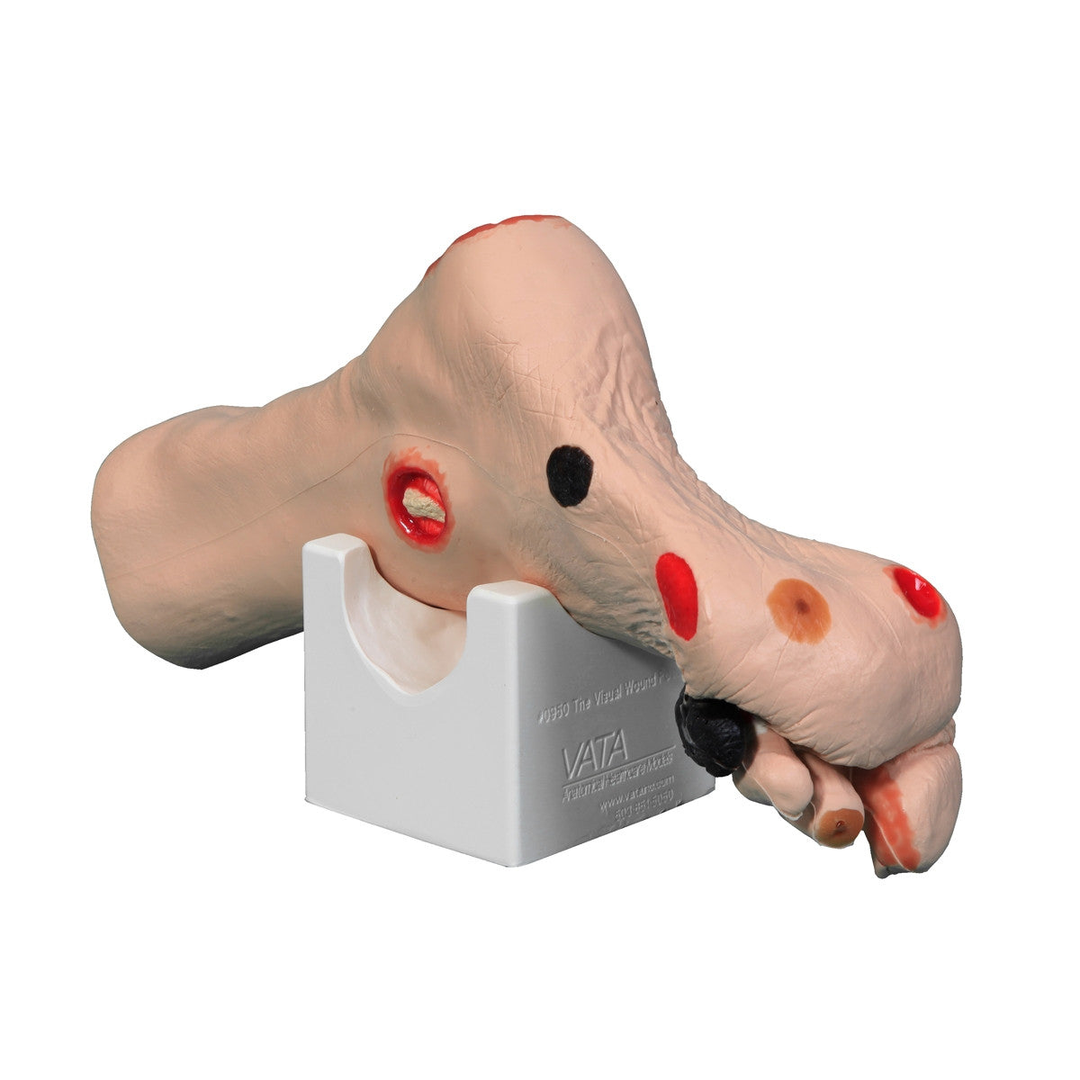 Wilma Wound Foot Trainer