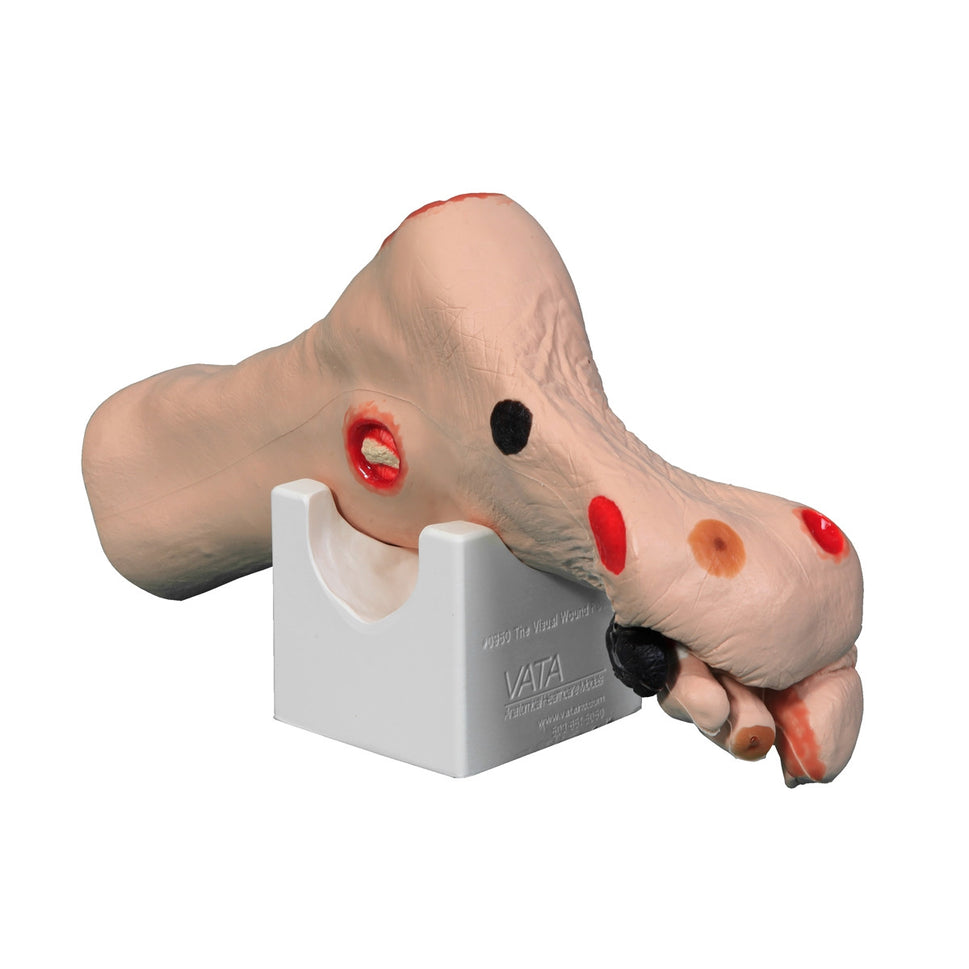 Wilma Wound Foot Trainer