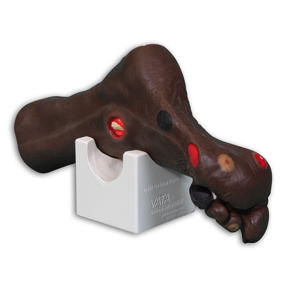 Wilma Wound Foot Trainer