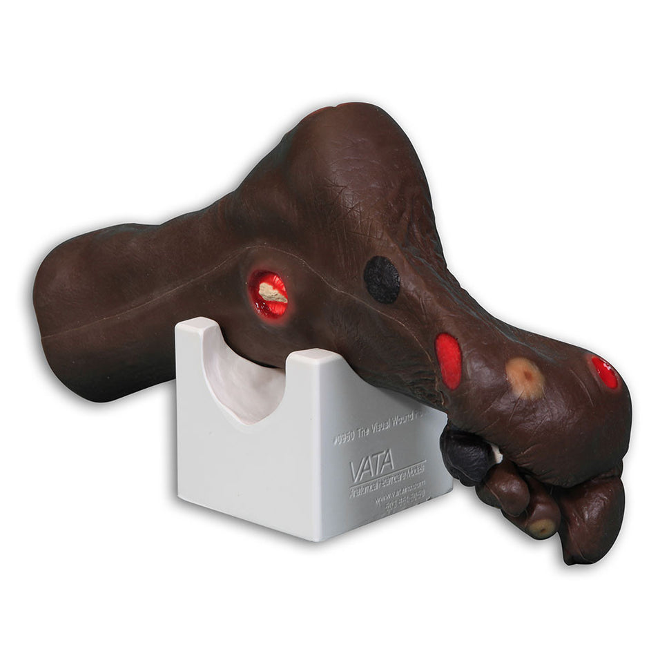 Wilma Wound Foot Trainer