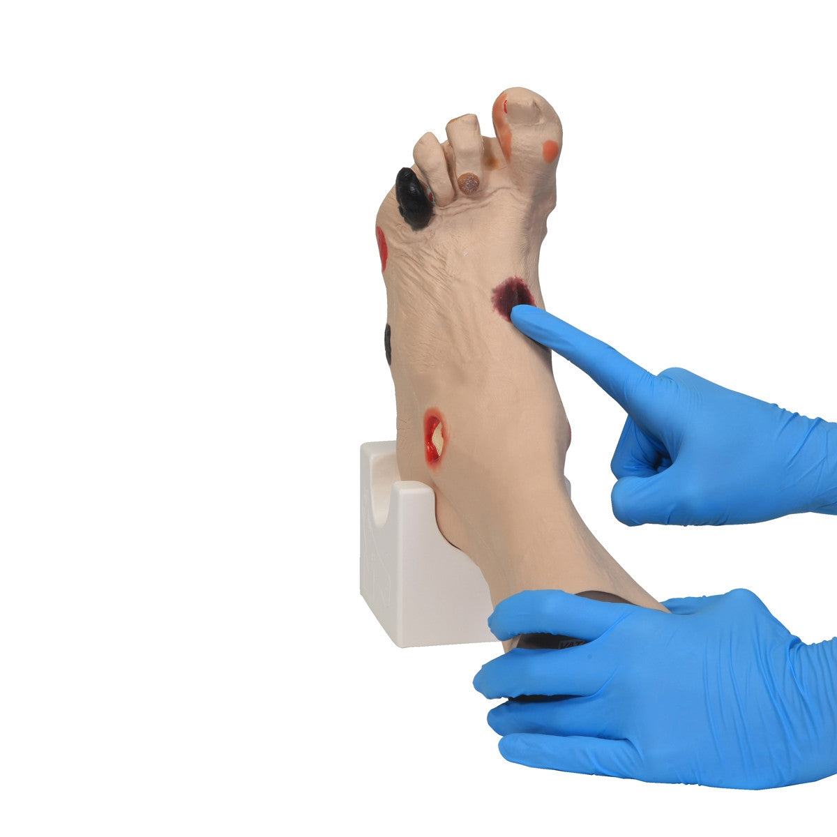 Realistic Feel of The DPI Wound of The Wilma Foot Trainer