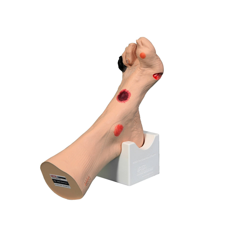Wilma Wound Foot Trainer