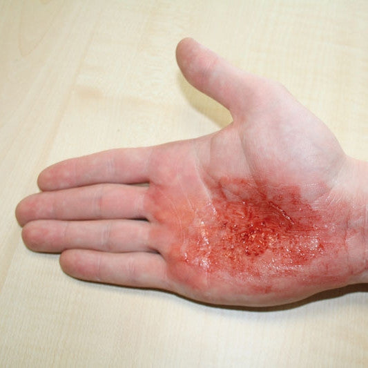 Basic Casualty Simulation Set