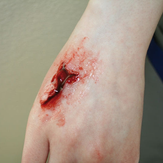 Basic Casualty Simulation Set