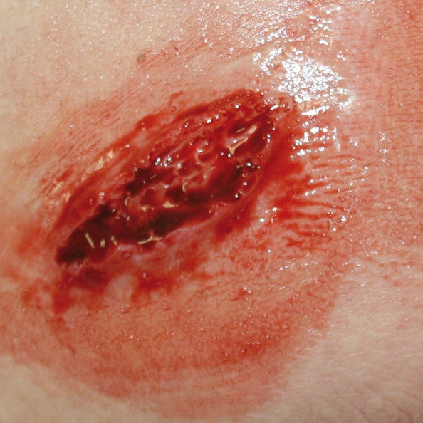 Basic Casualty Simulation Set