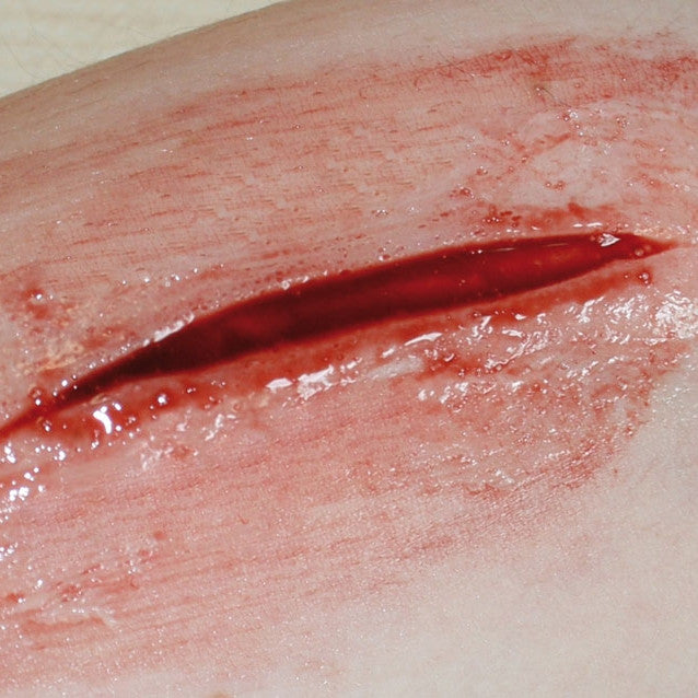 Basic Casualty Simulation Set