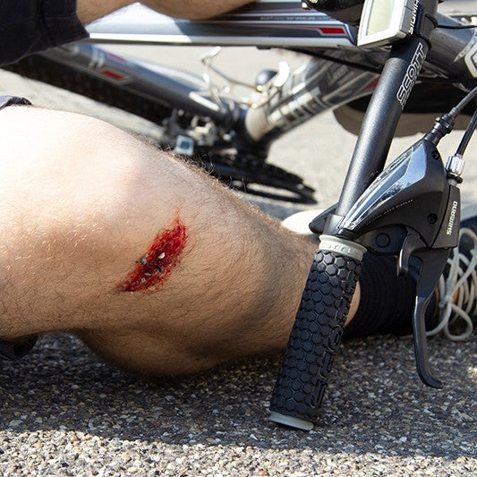 Basic Casualty Simulation Set