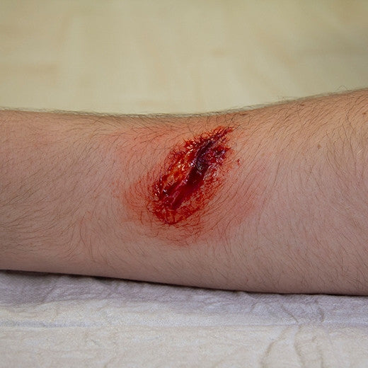 Basic Casualty Simulation Set