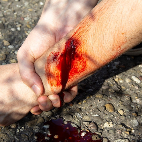 Basic Casualty Simulation Set