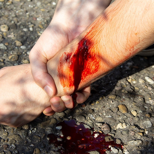 Intermediate Casualty Simulation Set