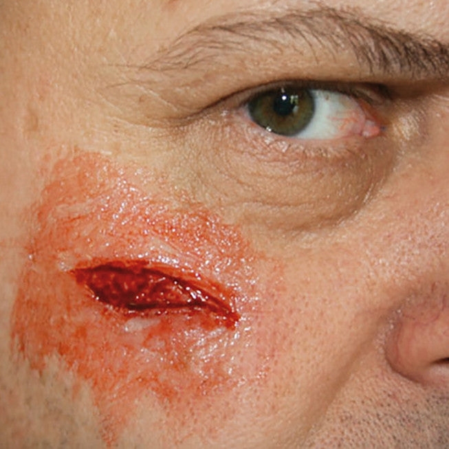 Intermediate Casualty Simulation Set