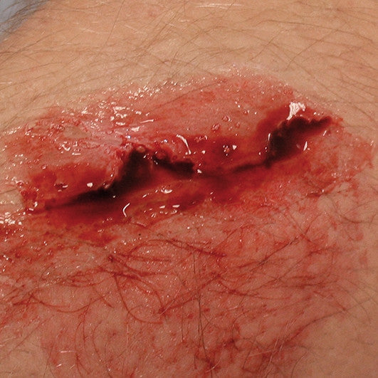 Intermediate Casualty Simulation Set