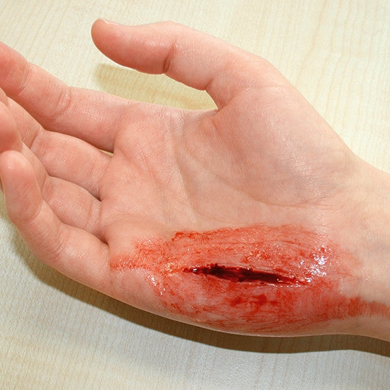 Intermediate Casualty Simulation Set