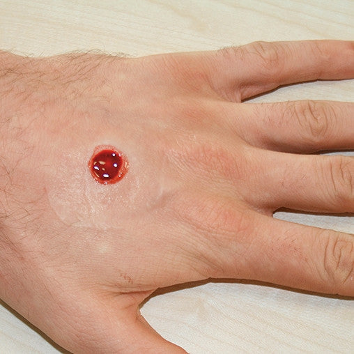 Intermediate Casualty Simulation Set