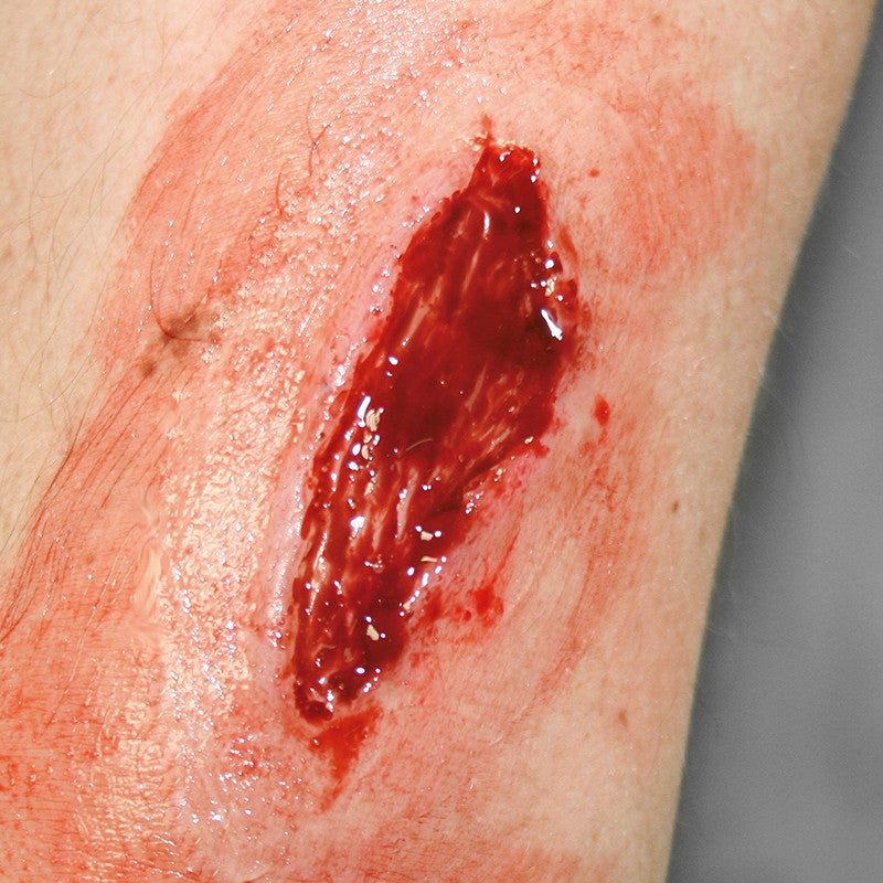 Intermediate Casualty Simulation Set