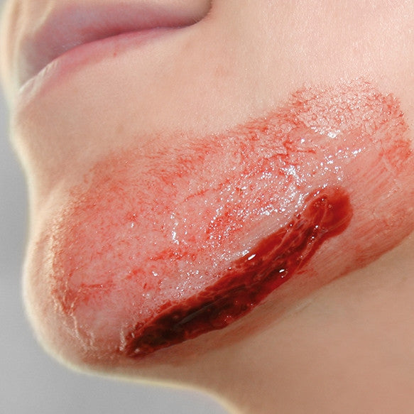 Intermediate Casualty Simulation Set