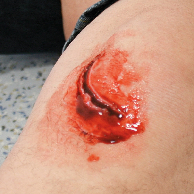 The wounds can be disposed of once use has ceased, saving you time and effort of cleaning and maintaining them