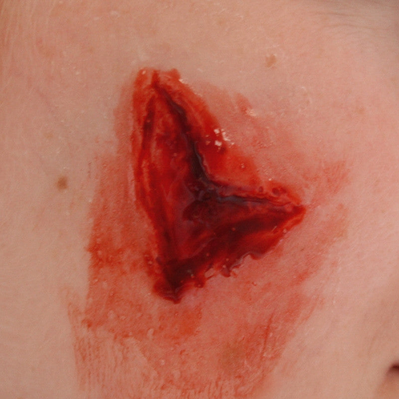 Intermediate Casualty Simulation Set can be used in training emergency service professionals