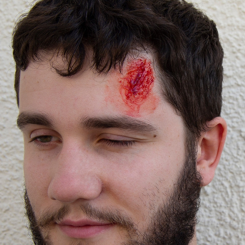 Intermediate Casualty Simulation Set