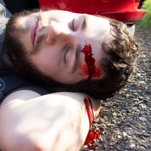 Intermediate Casualty Simulation Set