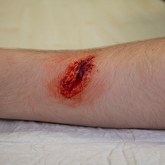 Intermediate Casualty Simulation Set