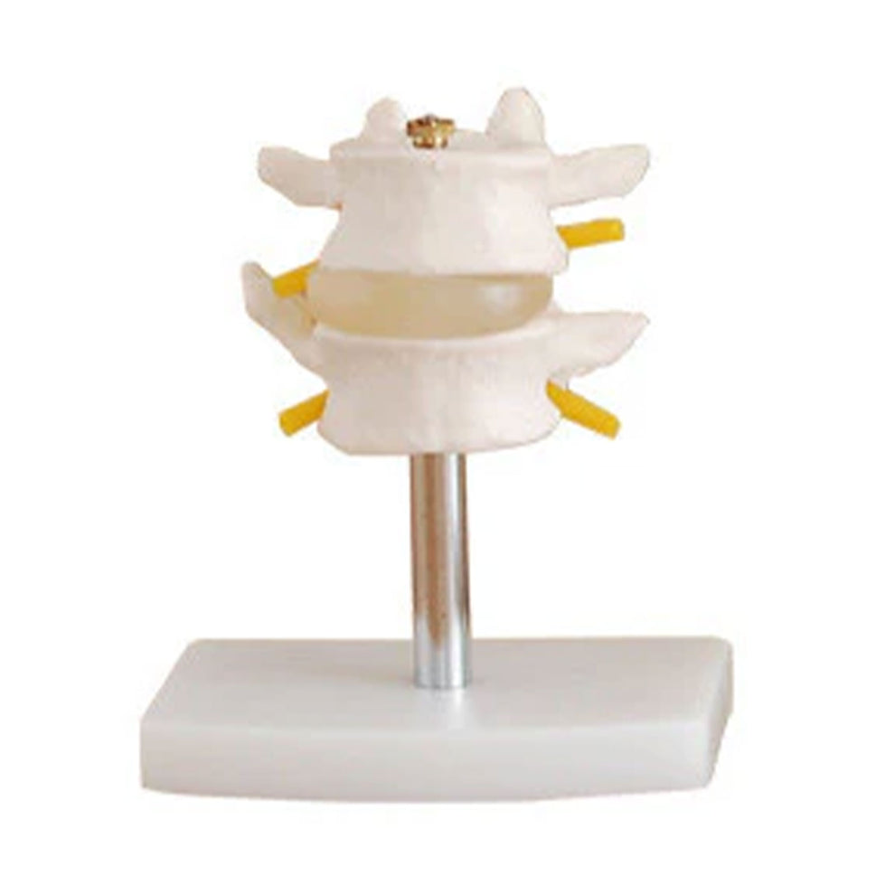 Budget Lumbar Vertebrae Model (2 part)