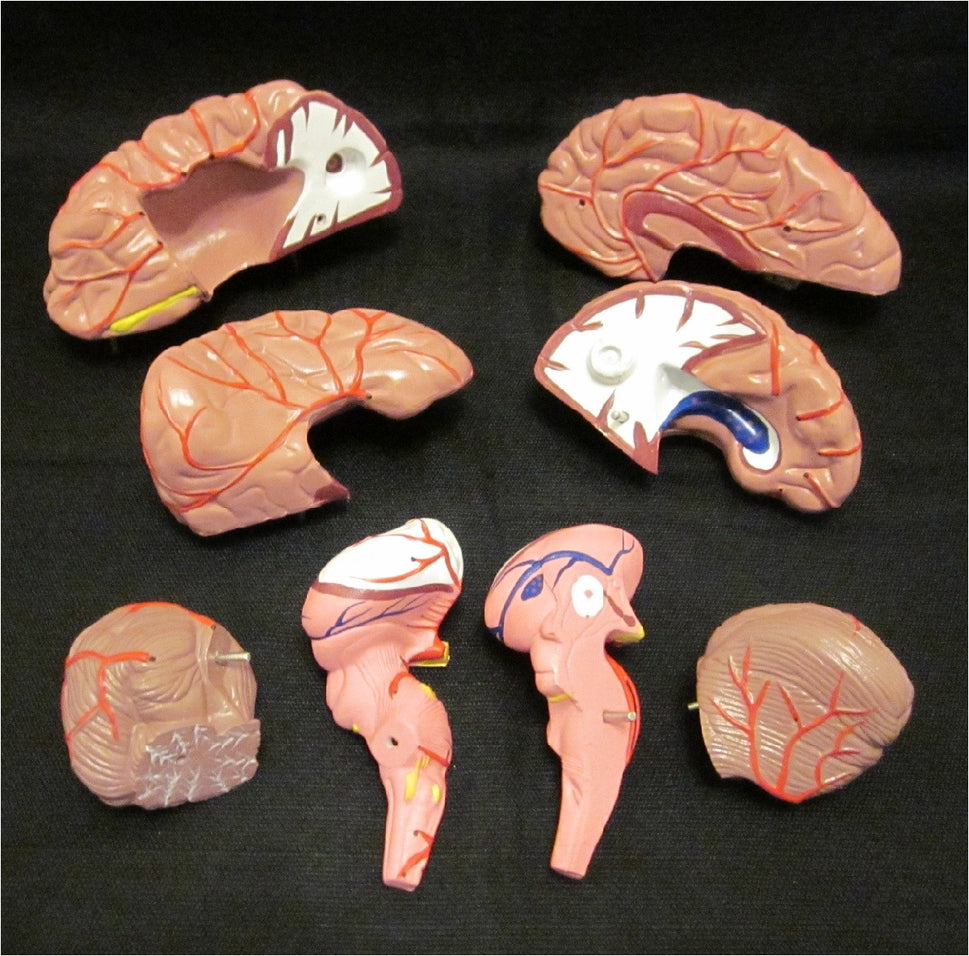 Budget Brain Model with Arteries (8 part)