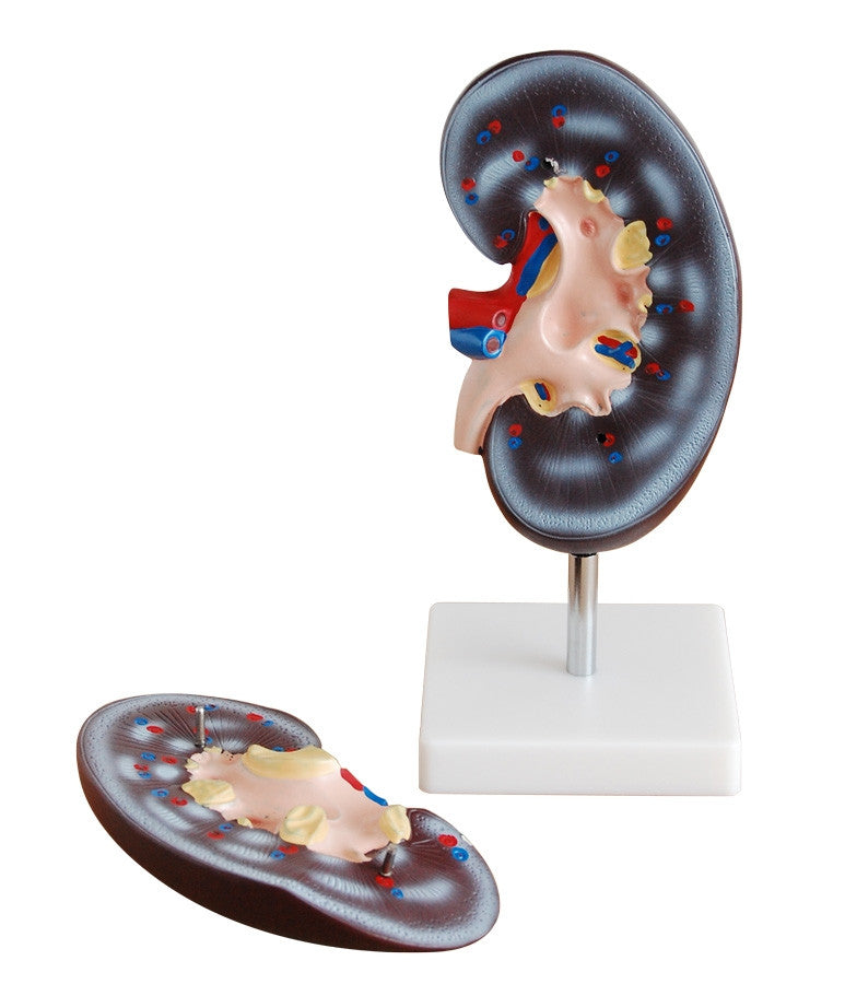 Budget Kidney Model (2 Times Life Size, 2 Part)