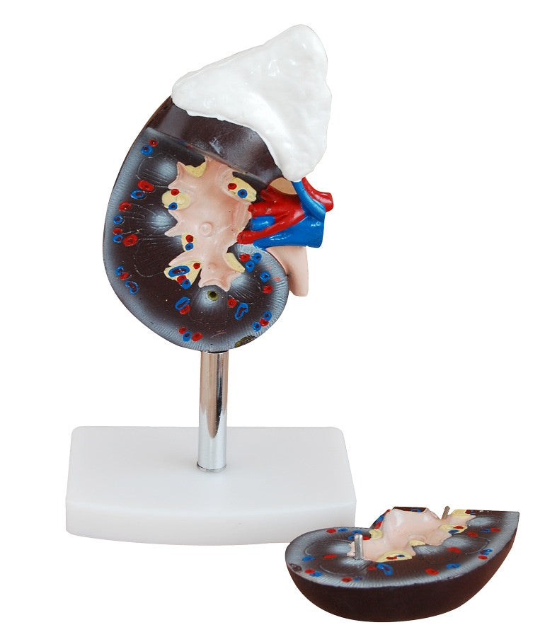 Budget Kidney Model with Adrenal Gland (2 Part)