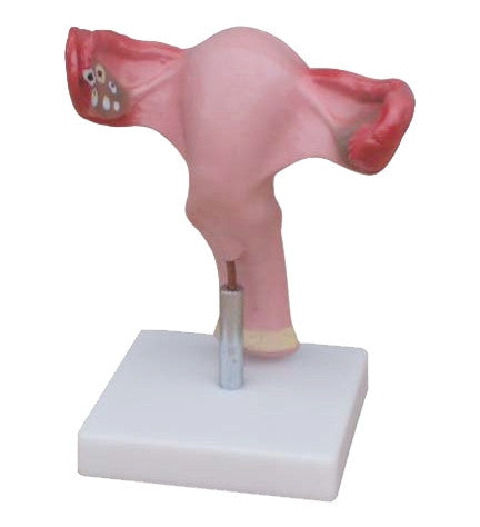 Budget Uterus and Vagina Model