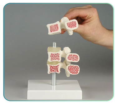 Lumbar Spine Models and Anatomy Posters