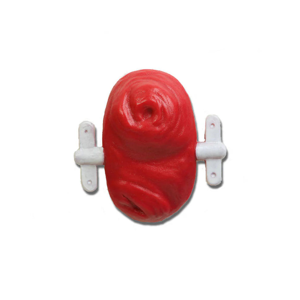 Loop Stoma With Rod For Otto Ostomy