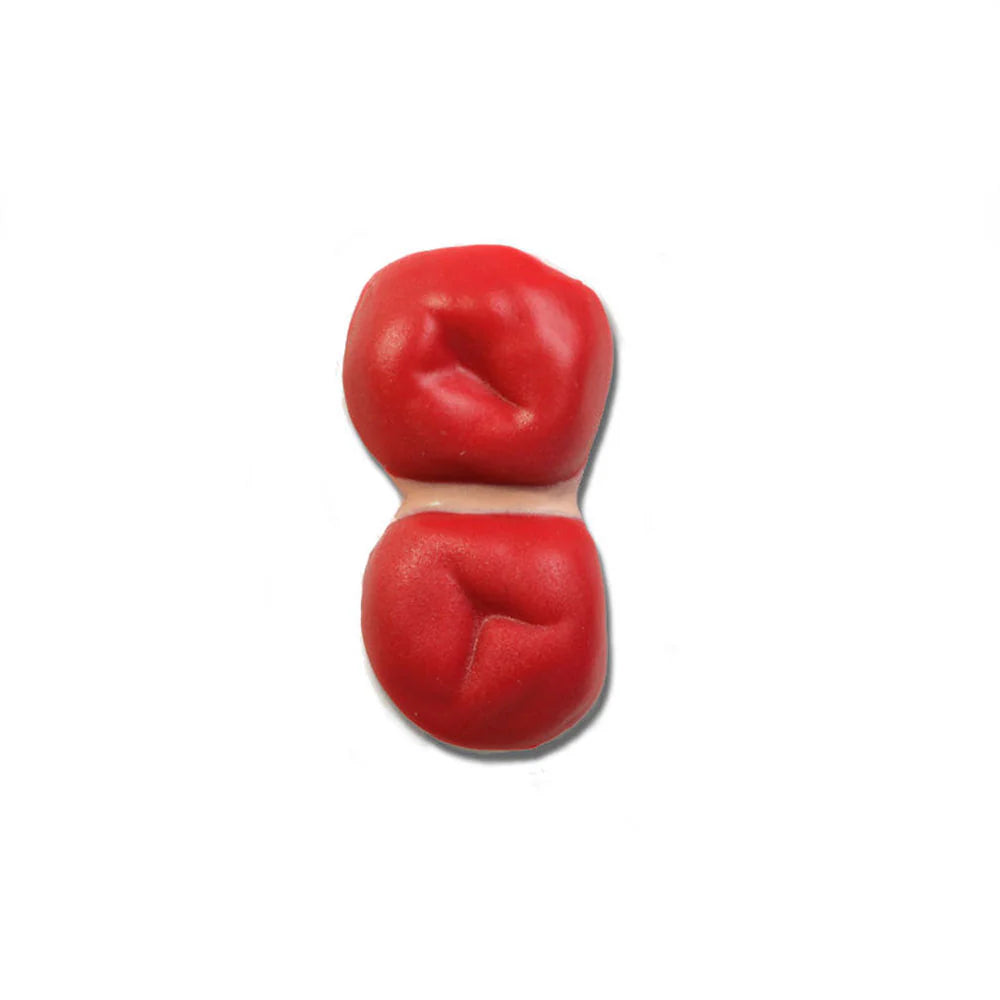 Double Barrel Stoma For Otto Ostomy