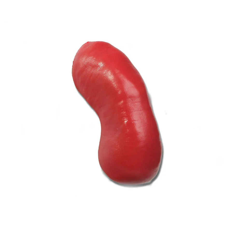 Prolapsed Stoma For Otto Ostomy
