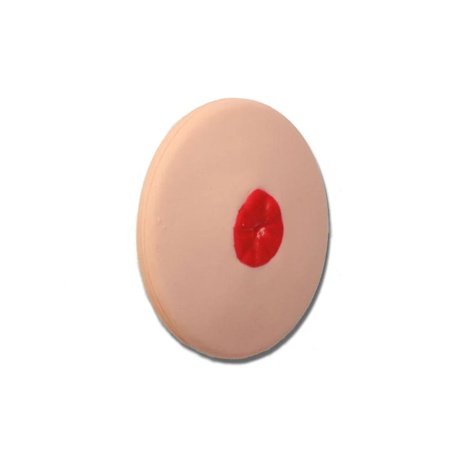 Flush Stoma For Otto Ostomy