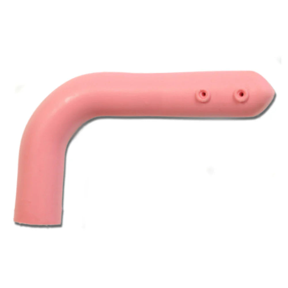 Illeal Conduit For Otto Ostomy