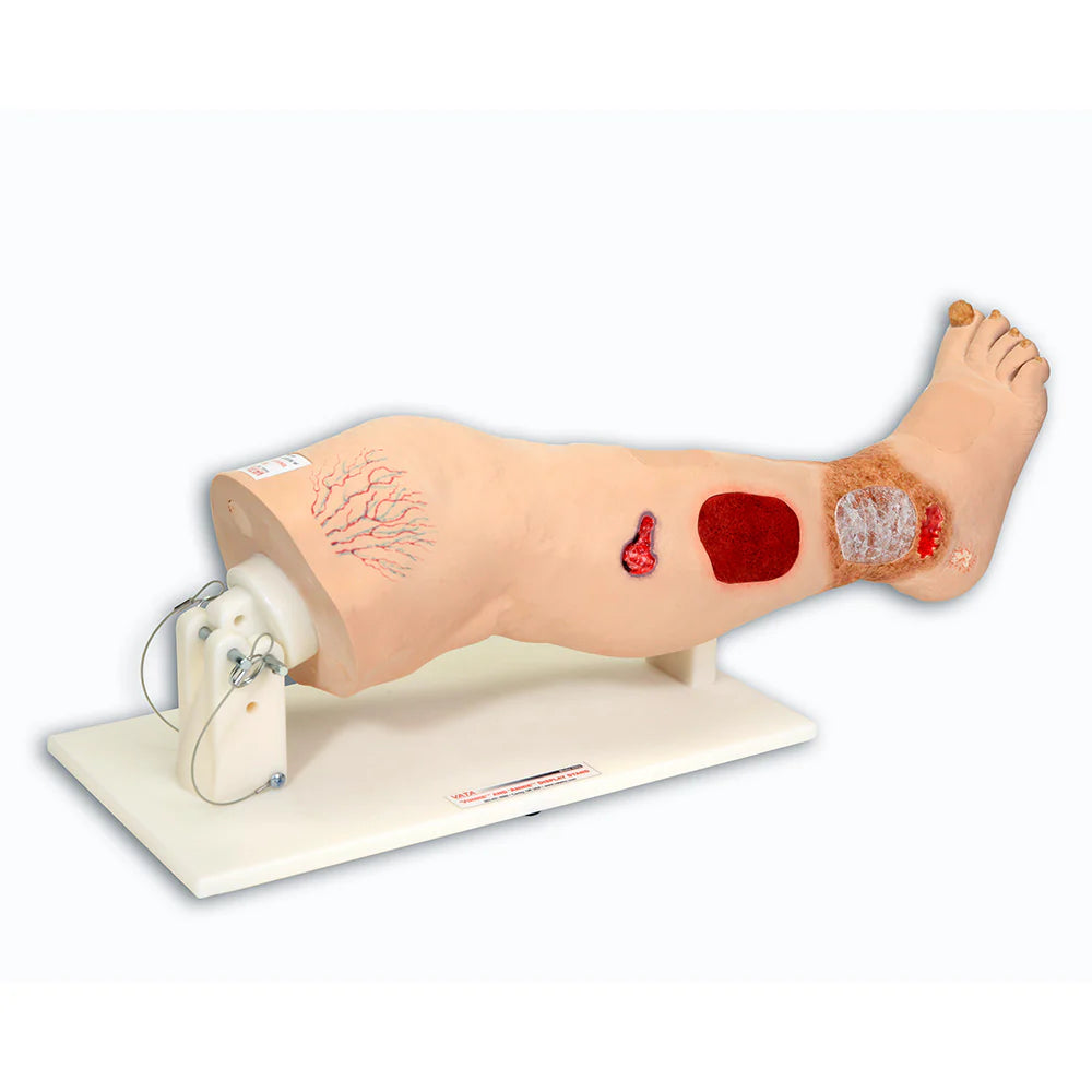 Vinnie Venous Insufficiency Leg VATA 0550